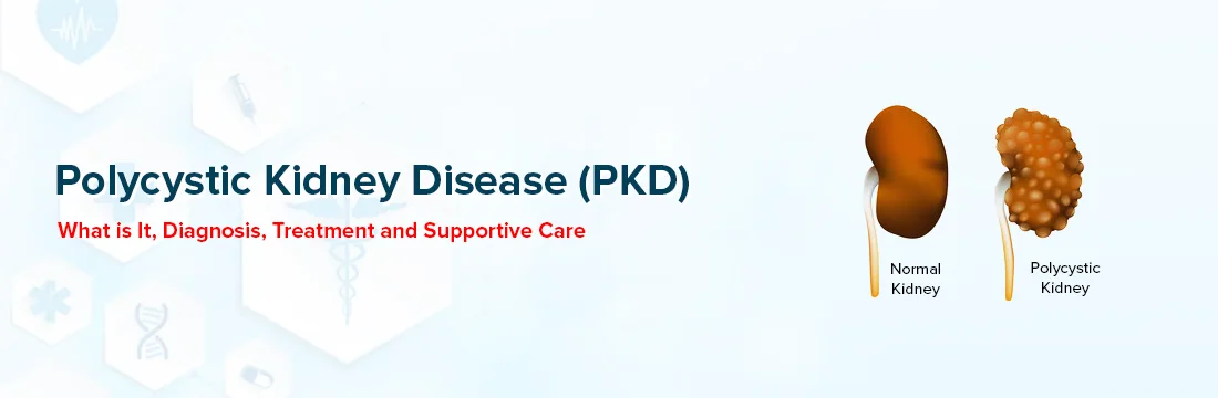 Polycystic Kidney Disease (PKD): What Is It, Diagnosis, Treatment and Supportive Care